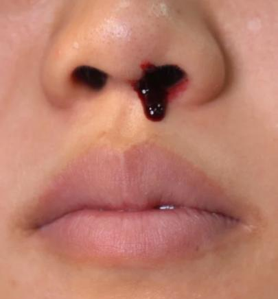 图片[3] - 广东天气持续干燥，昼夜温差大！网友：太干燥，流鼻血了？ - 黑料吃瓜-最新娱乐八卦爆料平台-明星热点新闻实时更新